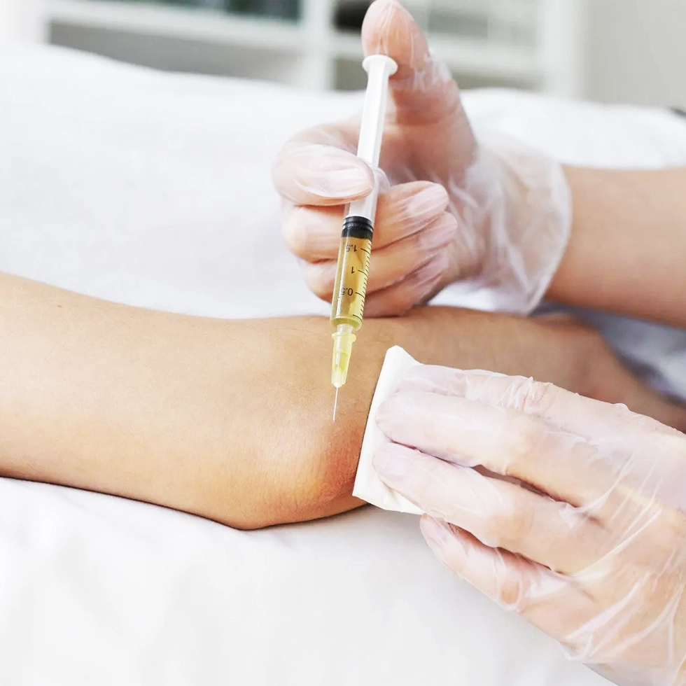 A2M / Fibrinogen Therapy