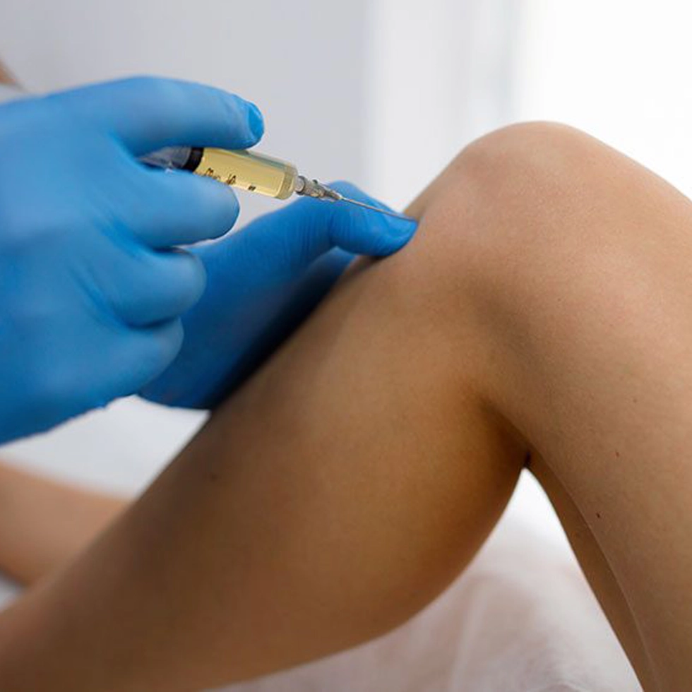 Extracellular Vesicle Injection at BionwoRx in Carmel Indiana Extracellular vesicle injection into a knee joint for pain relief and regeneration.
