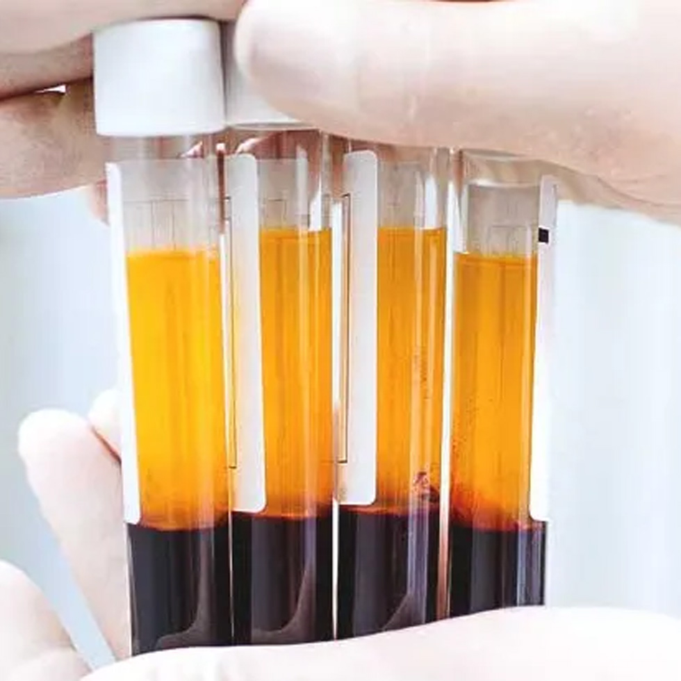 Extracellular Vesicle Therapy Extracellular vesicle therapy for regenerative healing at BionwoRx, Carmel, Indiana.