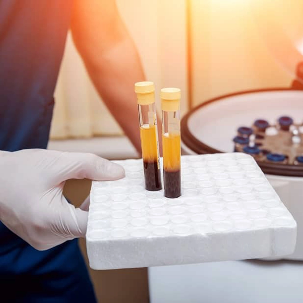 Extracellular Vesicle Therapy