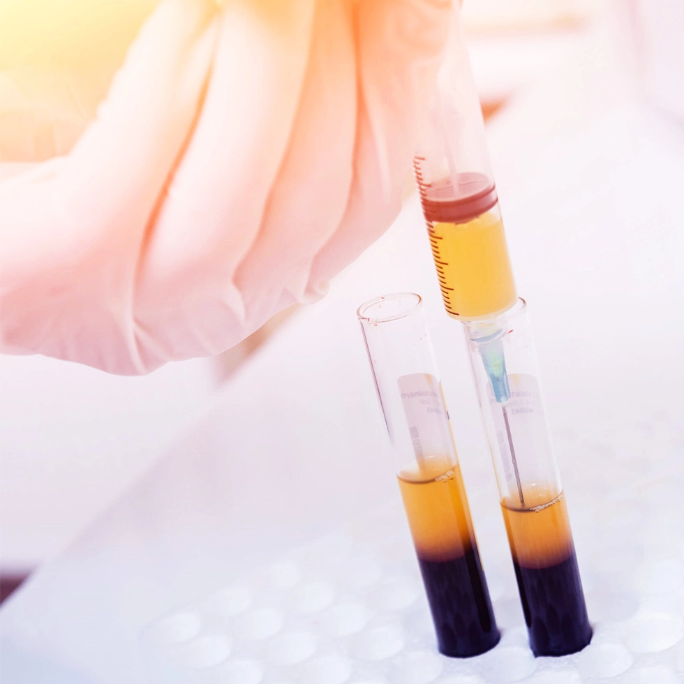 Regenerative Medicine at BionwoRx in Carmel Patient receiving regenerative medicine therapy at BionwoRx, Center for Functional and Regenerative Medicine in Carmel, Indiana, promoting natural healing and joint restoration.