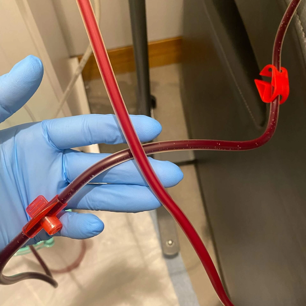 EBO2 Ozone Therapy – Filtered vs Unfiltered Blood Comparison at BionwoRx Carmel IN Side-by-side comparison showing EBO2 cleansed, oxygenated blood versus darker unfiltered blood during ozone therapy at BionwoRx in Carmel, Indiana