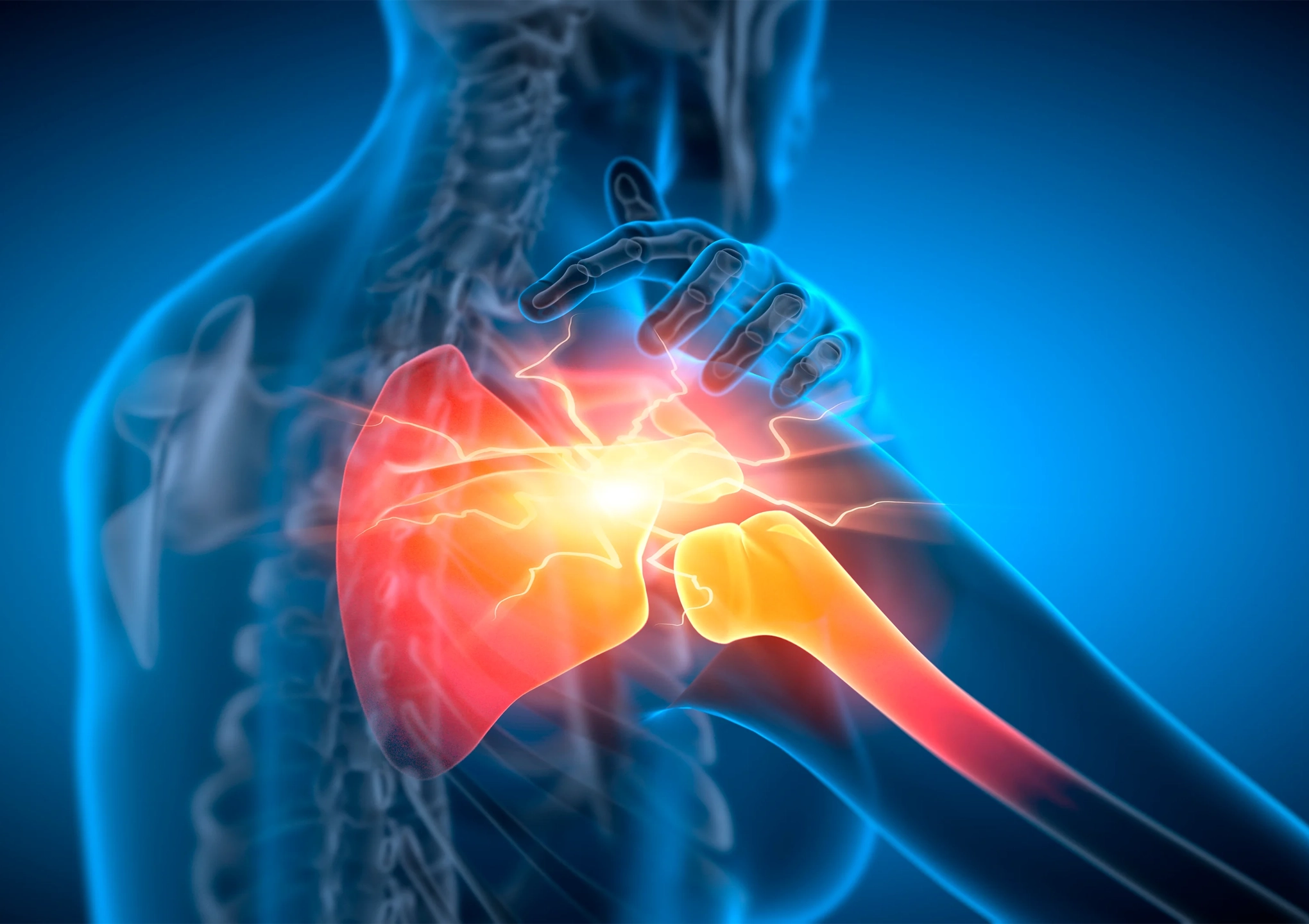 Medical illustration showing shoulder joint pain and inflammation, highlighting areas targeted by regenerative and stem cell therapies at BionwoRx: Center for Functional and Regenerative Medicine in Carmel, Indiana