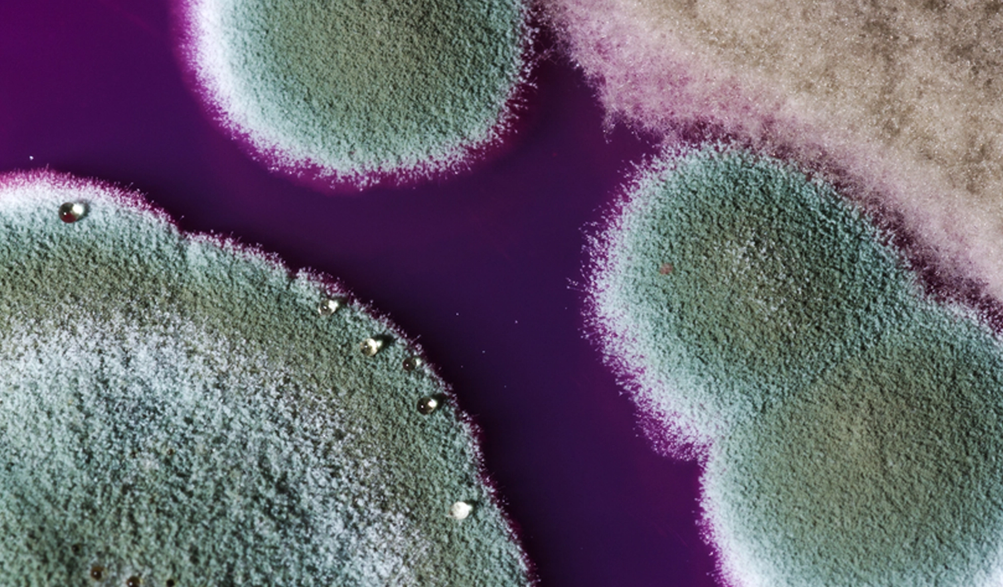 Toxic Mold Spores and Mycotoxin Exposure | BionwoRx Carmel Indiana Blood clot formed in EBO2 extracorporeal circuit due to inadequate anticoagulation during therapy
